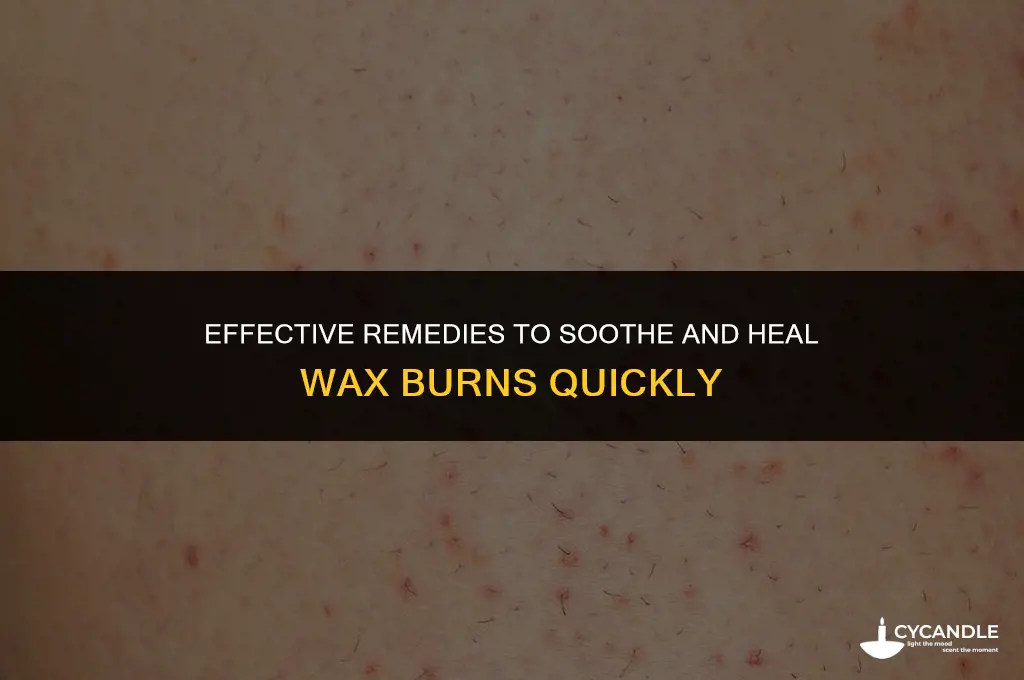 how do you get rid of wax burns