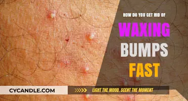 Quick Remedies to Soothe and Eliminate Waxing Bumps Rapidly