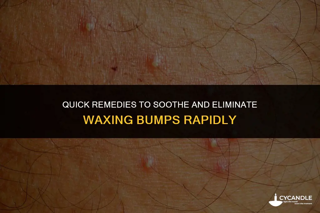 how do you get rid of waxing bumps fast