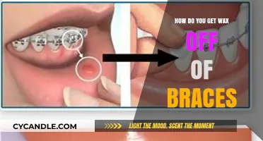 Effective Methods to Remove Wax from Braces: A Comprehensive Guide