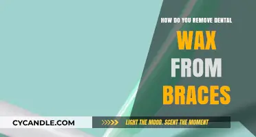 Easy Steps to Safely Remove Dental Wax from Braces at Home