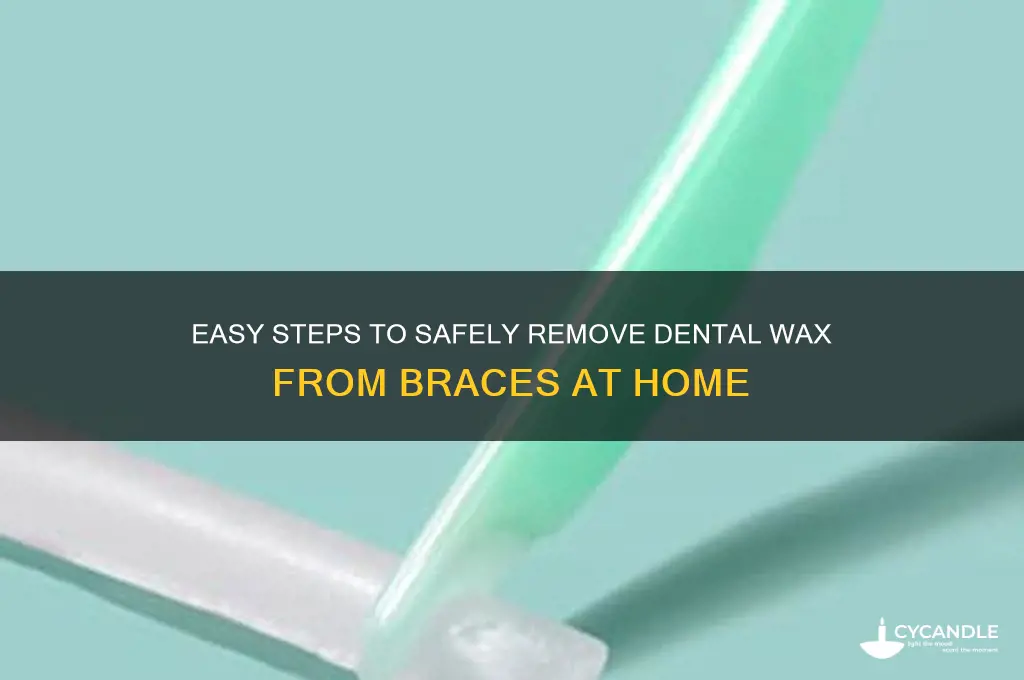 how do you remove dental wax from braces