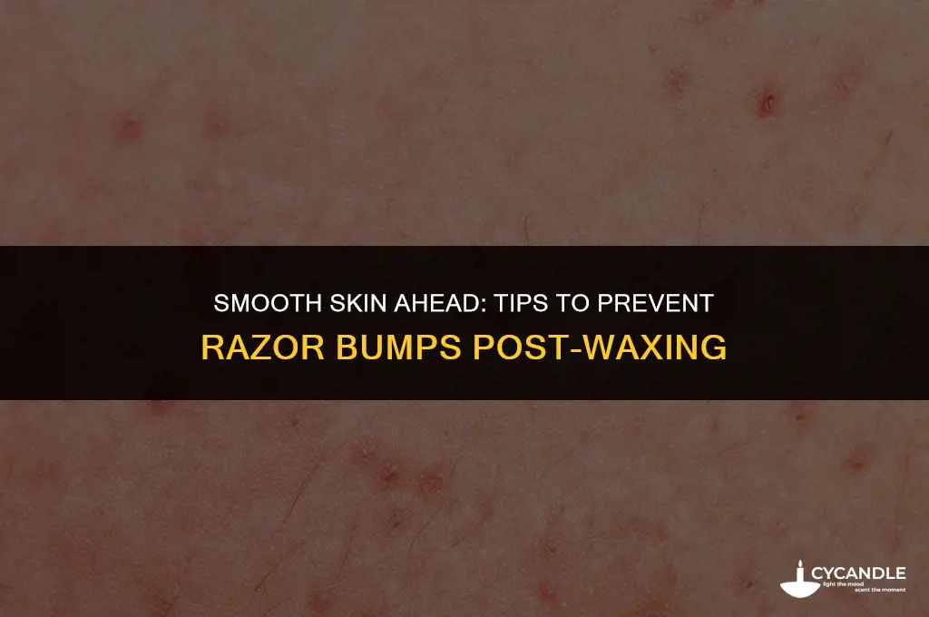 how do you stop razer bumps after getting waxed
