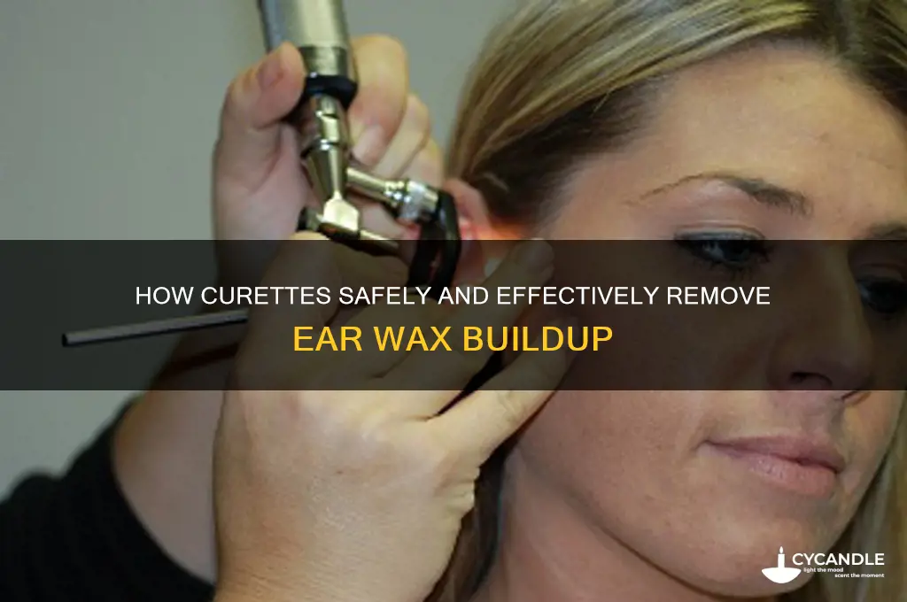 how does a curette remove ear wax