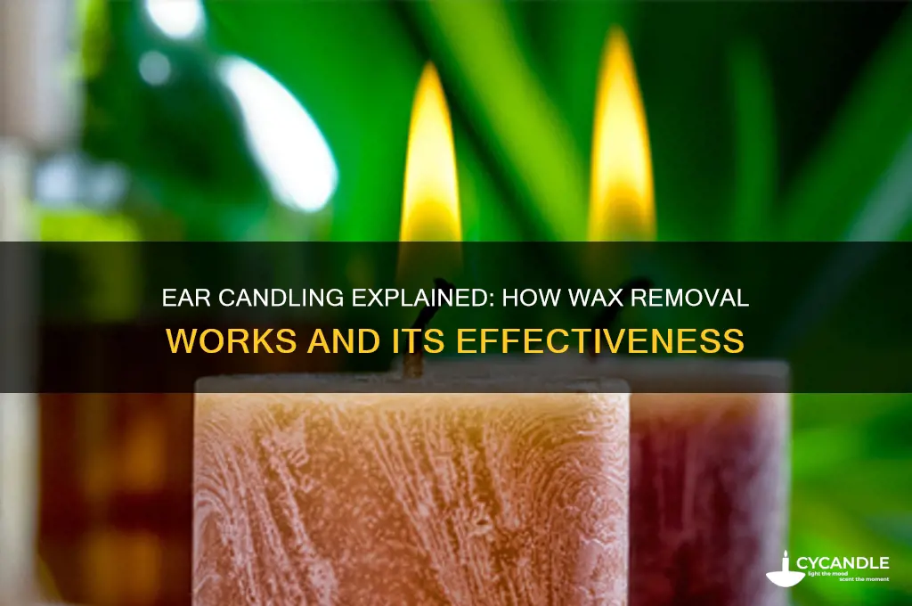 how does ear candle wax removal work