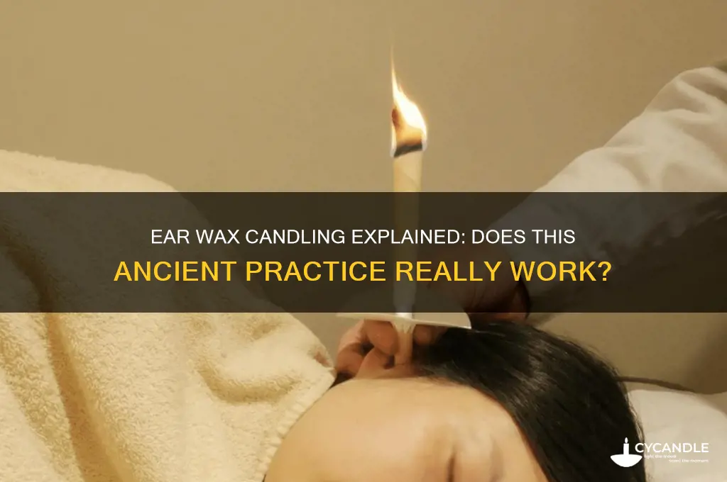 how does ear wax candling work