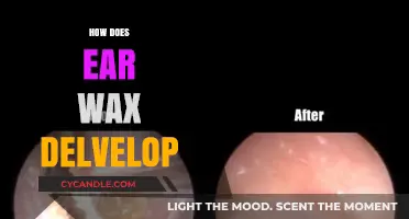 The Surprising Journey of Earwax: From Glands to Goodbye
