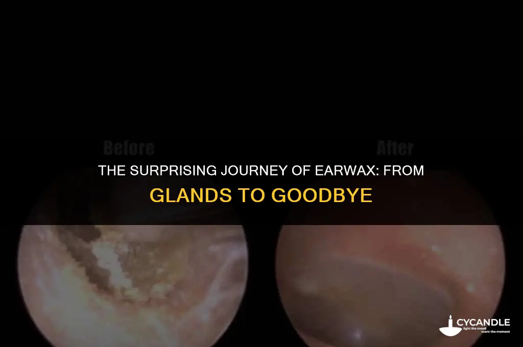 how does ear wax delvelop