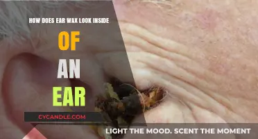 Exploring the Appearance of Earwax Within the Ear Canal