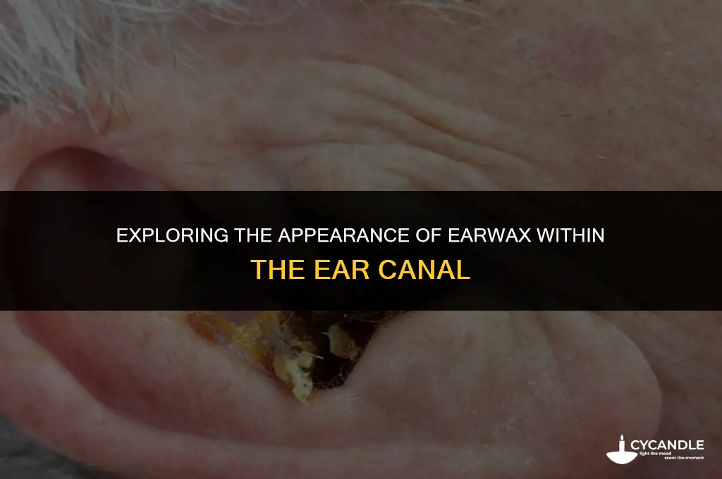 how does ear wax look inside of an ear