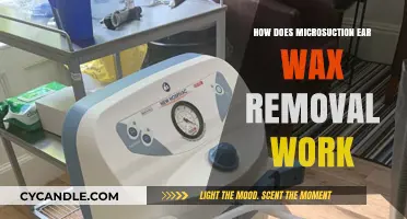 Understanding Microsuction: A Gentle, Effective Ear Wax Removal Technique