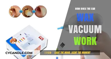Exploring the Mechanics of Ear Wax Vacuum Cleaners