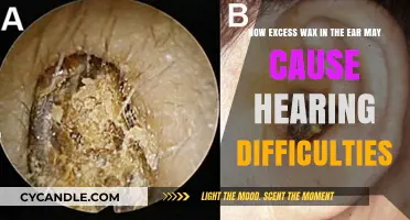 Ear Wax Buildup: The Surprising Culprit Behind Hearing Loss