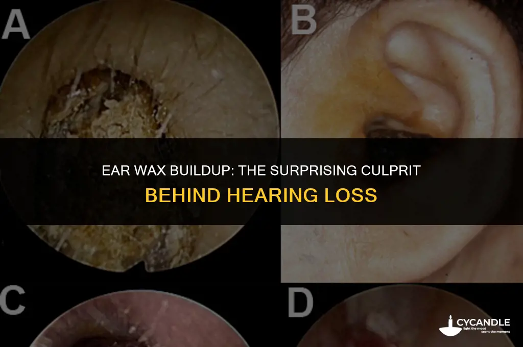 how excess wax in the ear may cause hearing difficulties