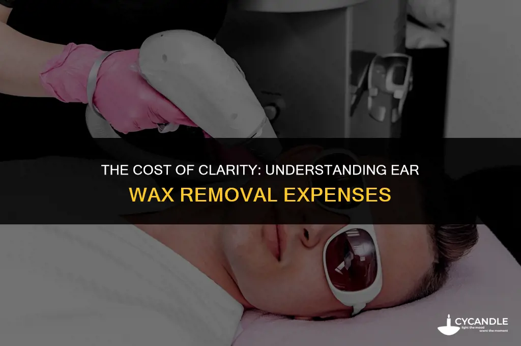 how expensive is ear wax removol