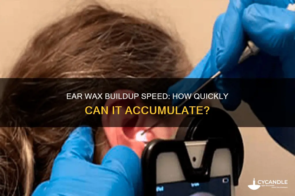 how fast can ear wax build up