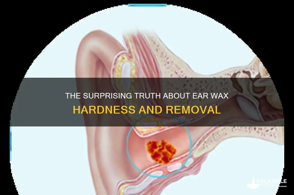 how hard can ear wax get