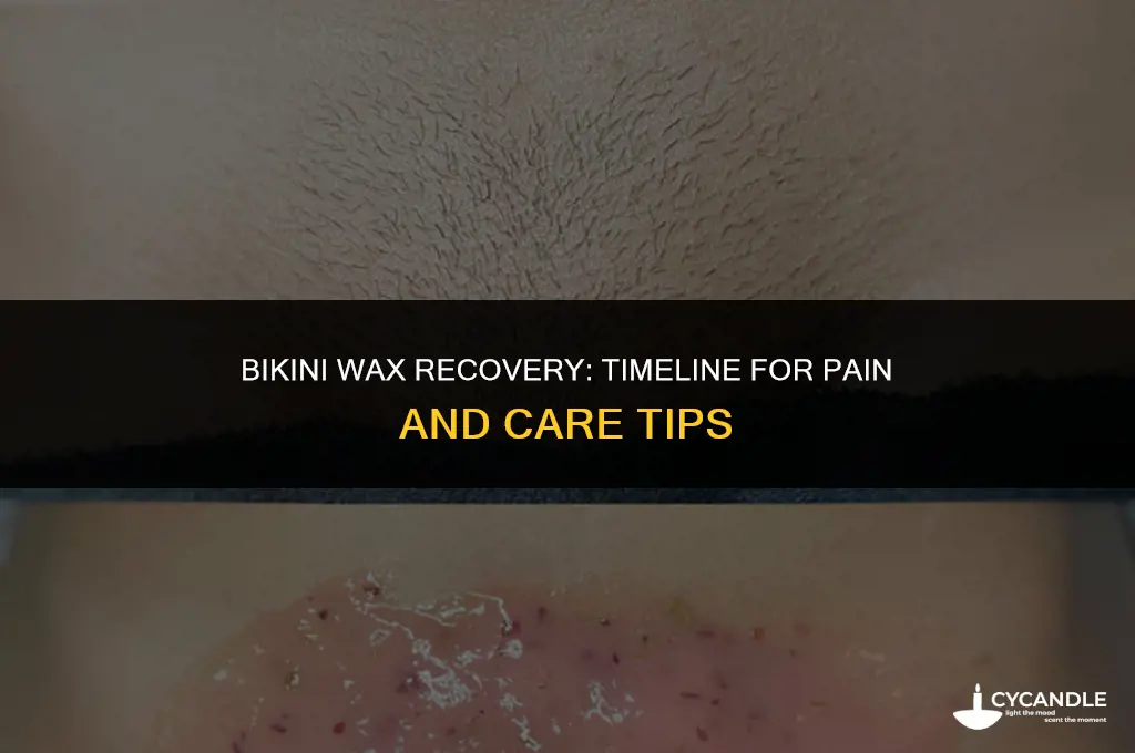 how long after a bikini wax does it hurt