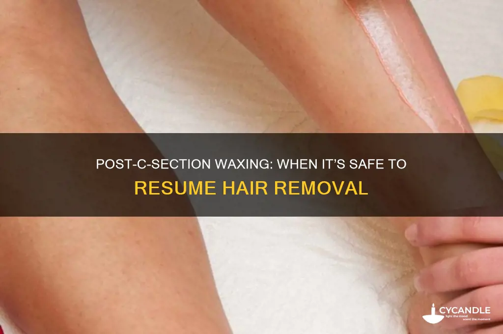 how long after a c section can you get waxed