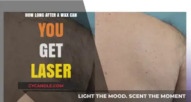 Post-Wax to Laser: Timing Your Hair Removal Transition Smoothly