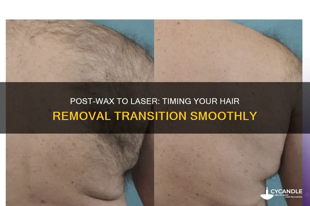 how long after a wax can you get laser
