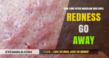 Soothing Skin: Timeline for Redness Relief Post-Brazilian Wax
