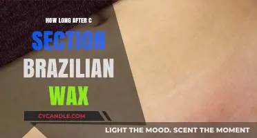 Post-C-Section Brazilian Wax: Timing and Safety Considerations