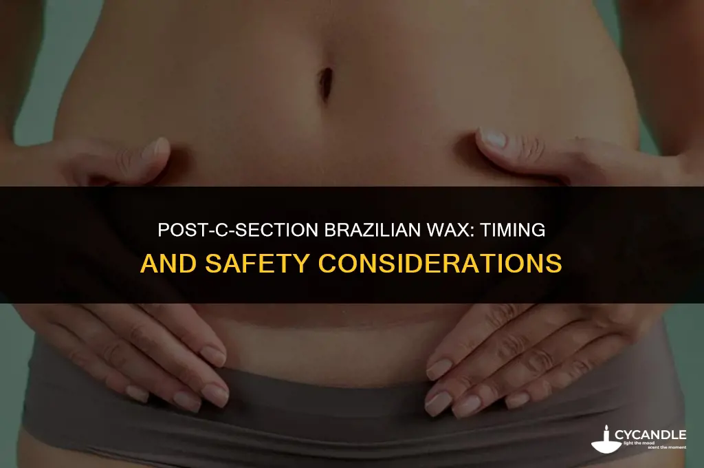 how long after c section brazilian wax