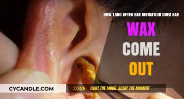 Ear Wax Removal: What to Expect After Irrigation