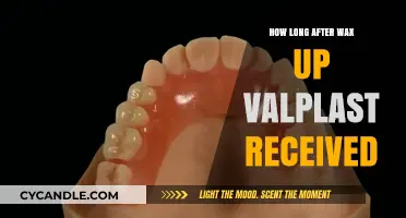 Understanding the Timeline: When to Expect Your Valplast After Wax Up