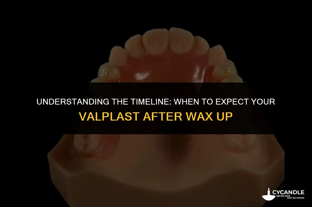how long after wax up valplast received