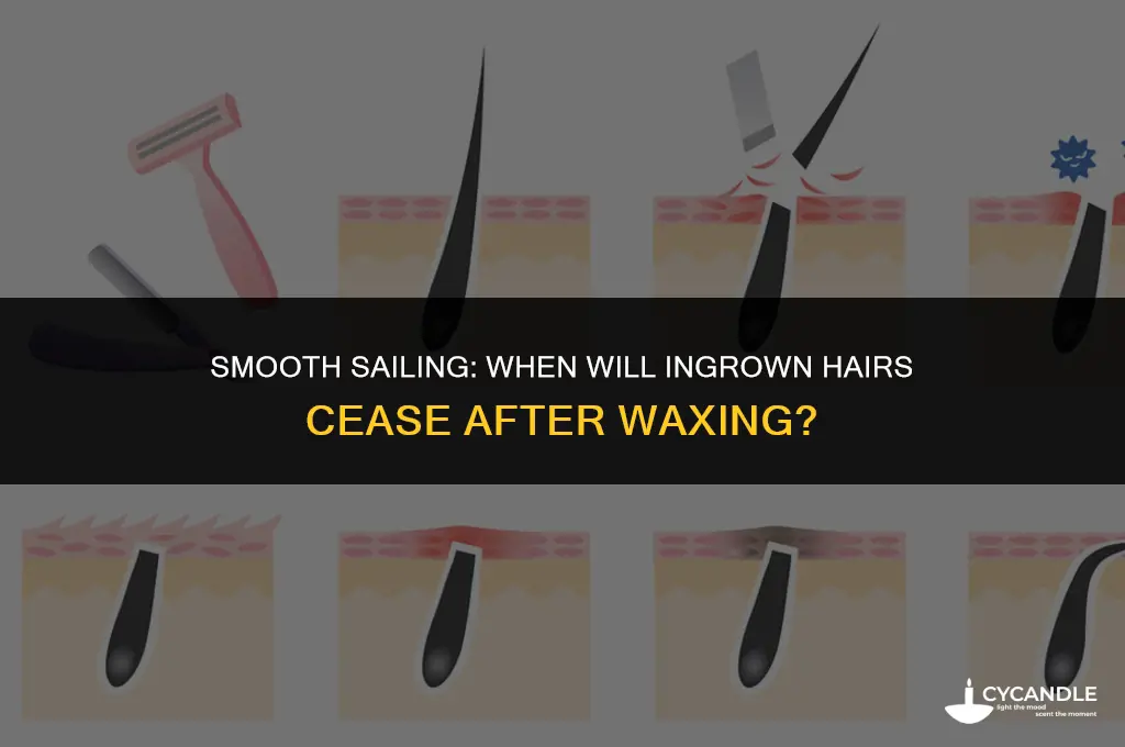 how long before ingrown hairs stop from waxing