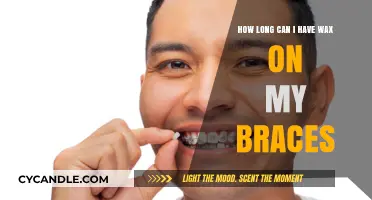 Wax on Braces: How Long Can You Safely Keep It?