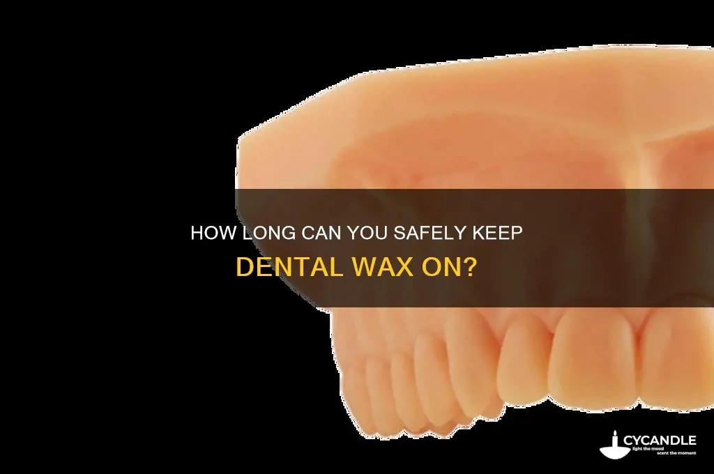 how long can i keep dental wax on