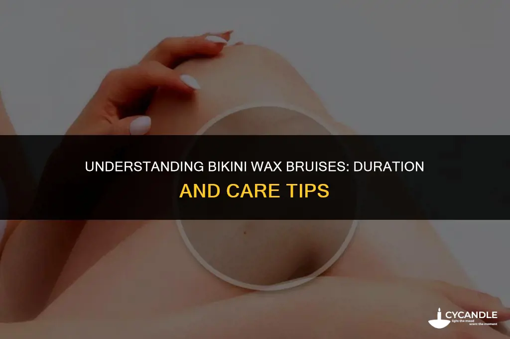 how long do bikini wax bruises last