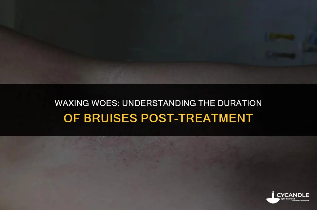 how long do bruises from waxing last