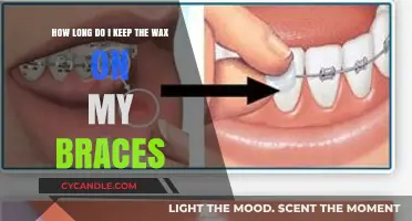 Braces Wax Duration: Tips for Optimal Orthodontic Care