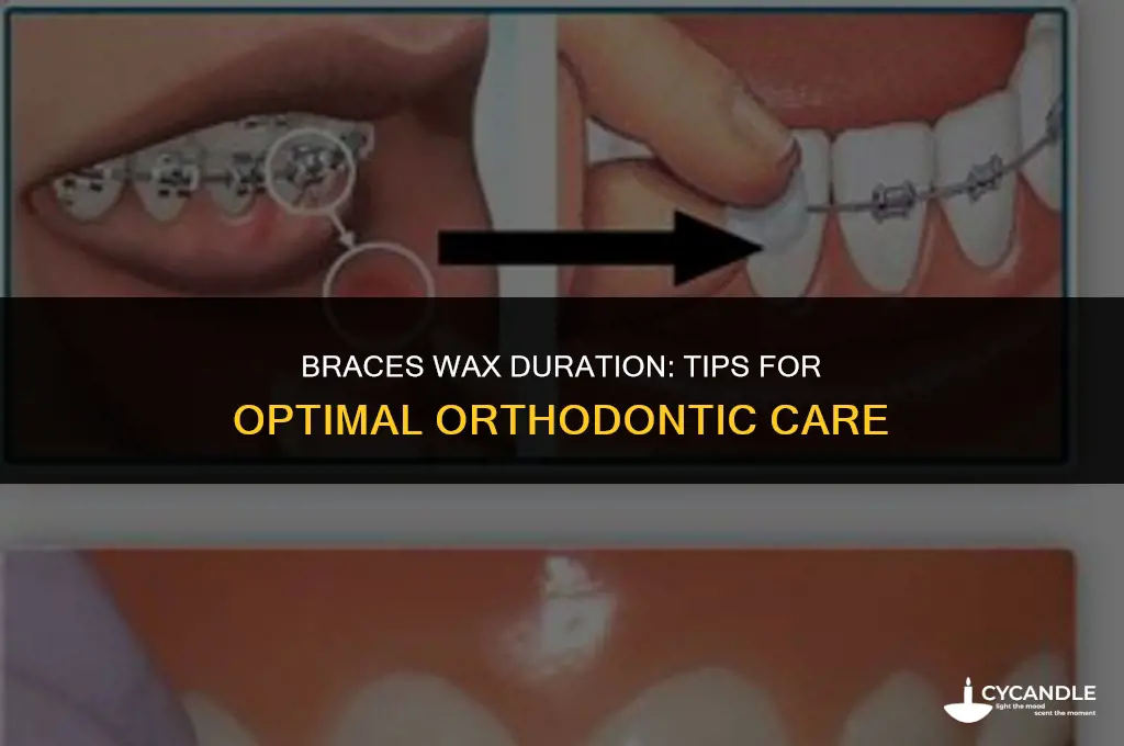 how long do i keep the wax on my braces
