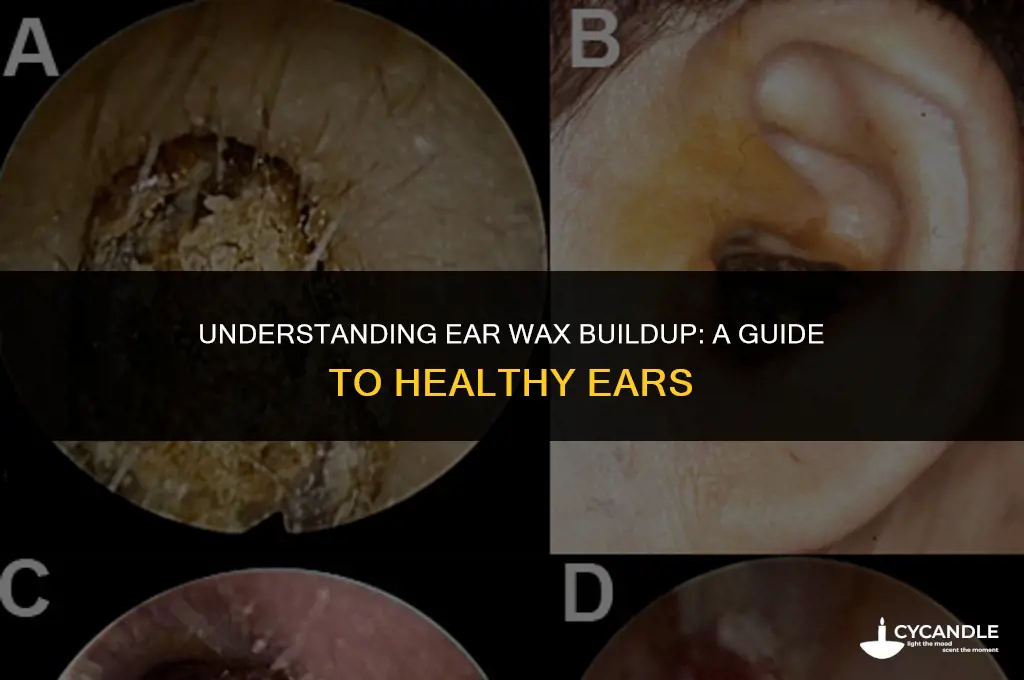 how long do i need to ear wax
