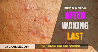Understanding Post-Waxing Pimples: Duration and Prevention Tips