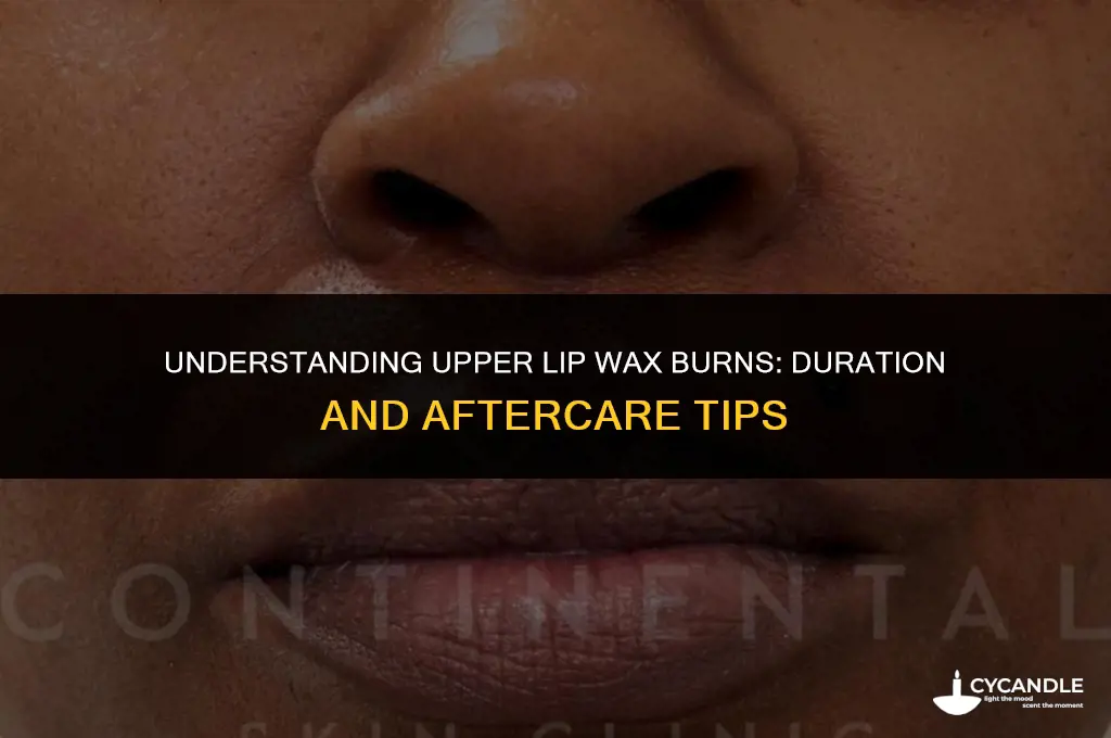 how long do upper lip wax burns last
