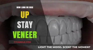 The Durability of Wax-Up Veneers: A Comprehensive Guide