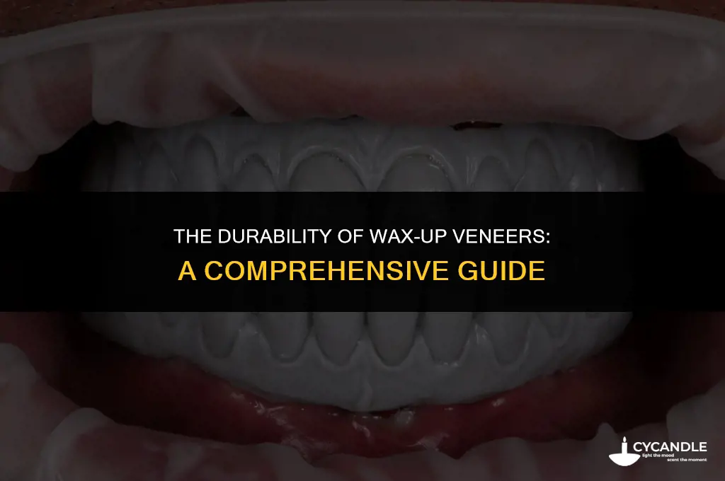 how long do wax up stay veneer