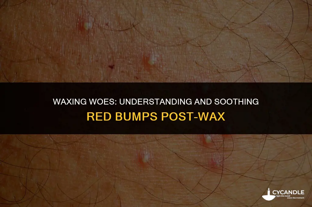 how long do you get red bumps from waxing