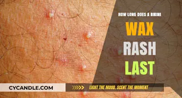 Understanding Bikini Wax Rash Duration: A Comprehensive Guide
