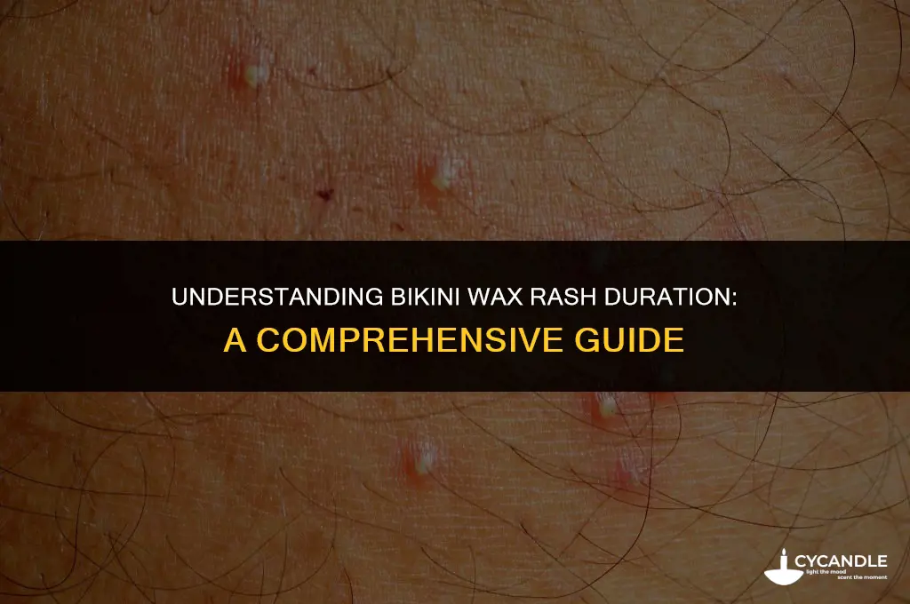 how long does a bikini wax rash last