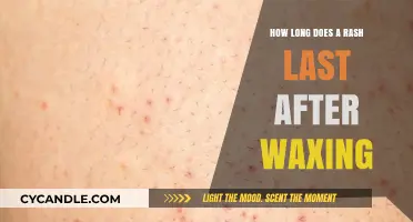 Waxing Woes: Understanding the Duration of Post-Wax Rashes