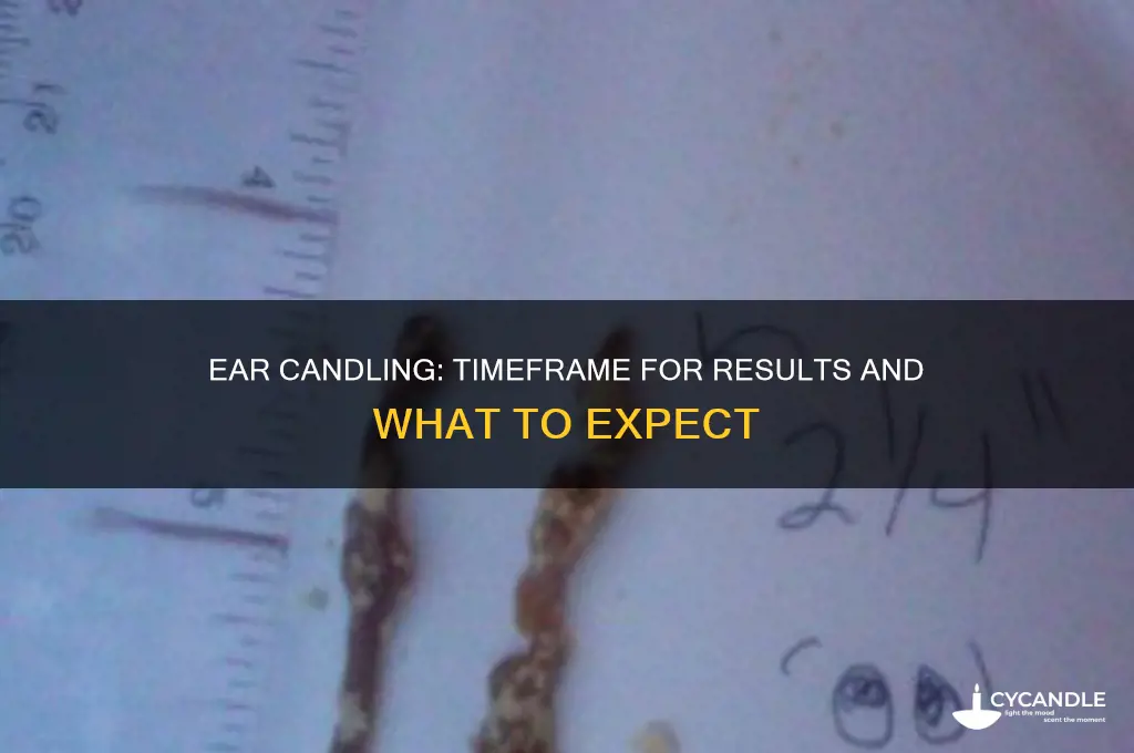 how long does ear candling take to work