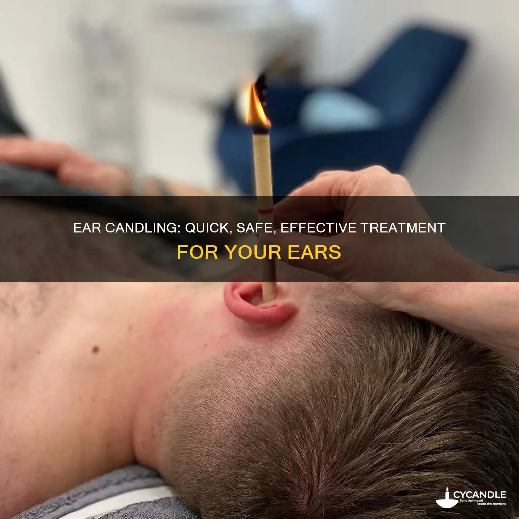 how long does ear candling take
