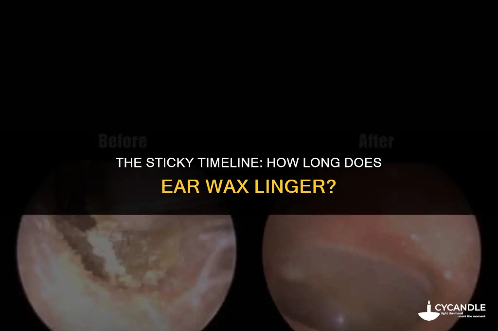 how long does ear wax stay in your system